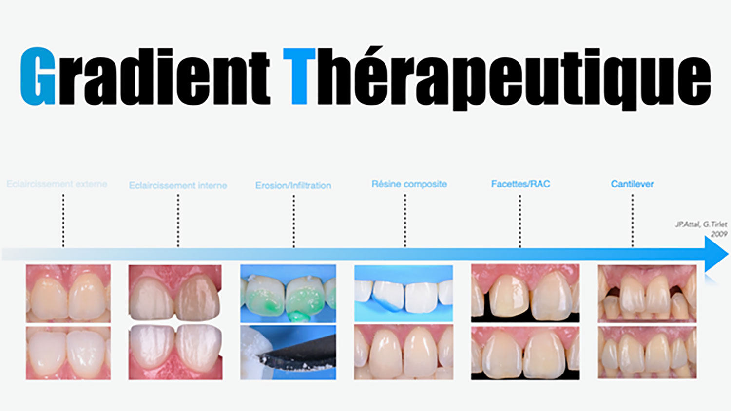 Esthetique-dentaire-we-smile