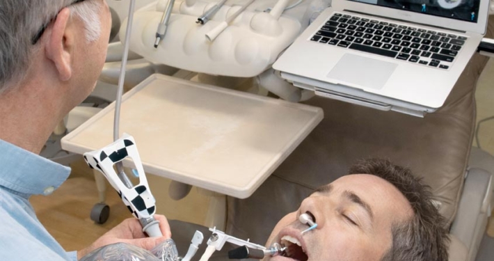 X-Guide® : chirurgie implantaire ultra-précise – We Smile