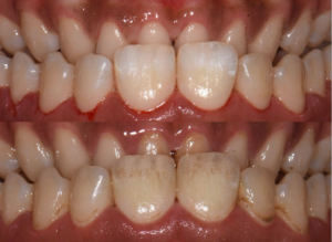 hygiène bucco-dentaire - WeSmile