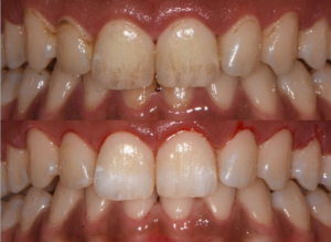 hygiène-bucco-dentaire-wesmile2